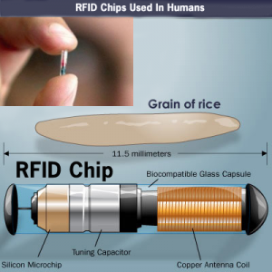 rfid chip in humans 2022